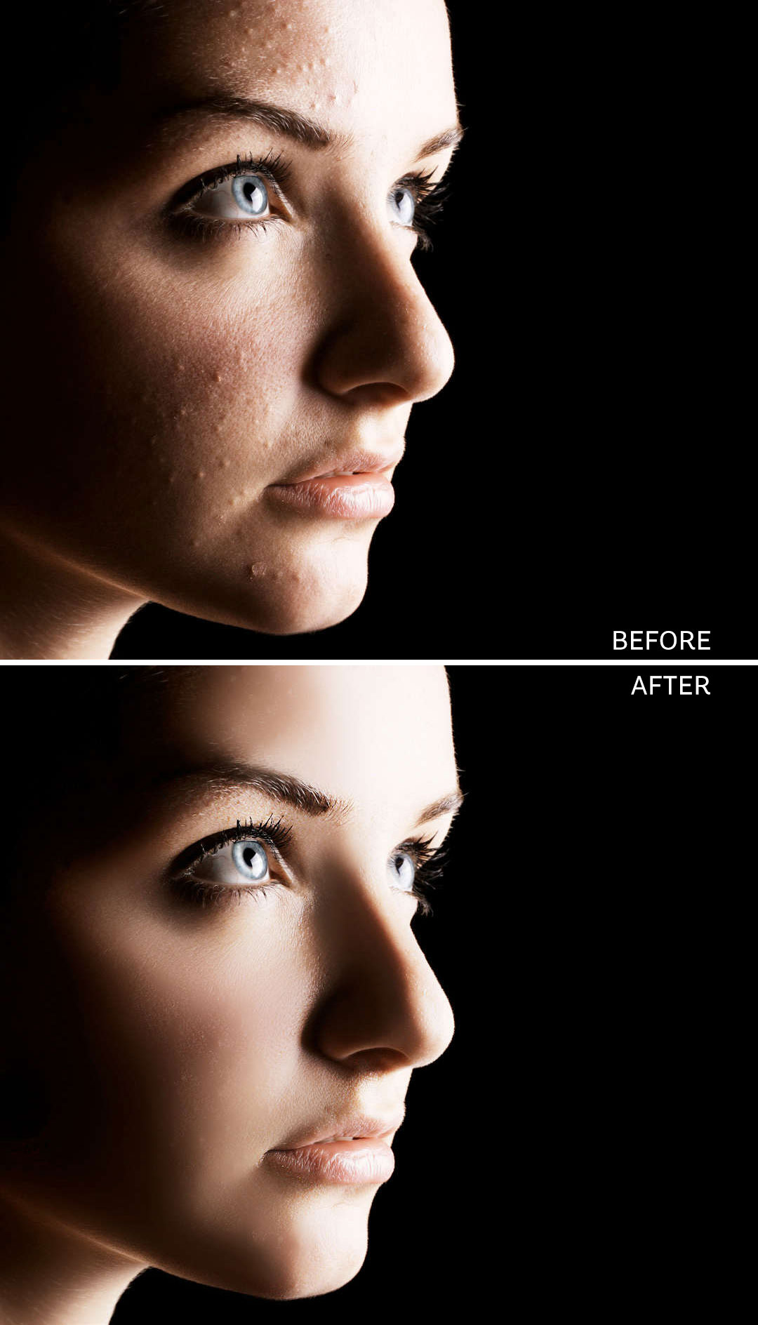 Photo Skin pimples before after editing photoshop psd file for photography 